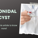 pilonidal cyst