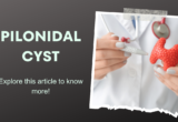 pilonidal cyst