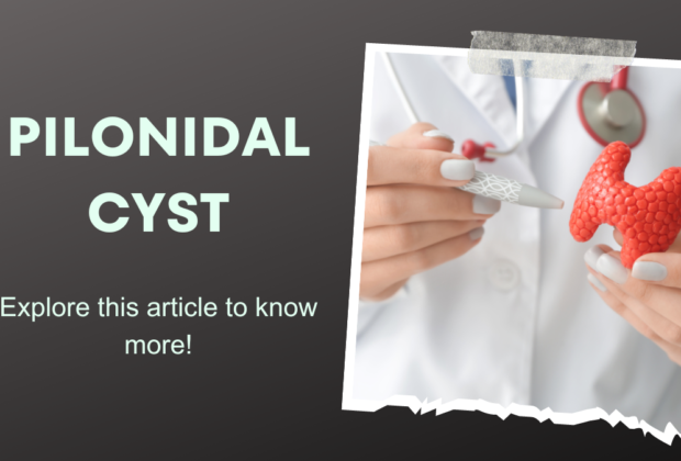 pilonidal cyst