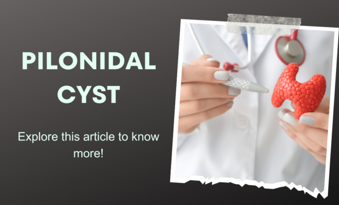 pilonidal cyst