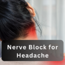 nerve block for headache